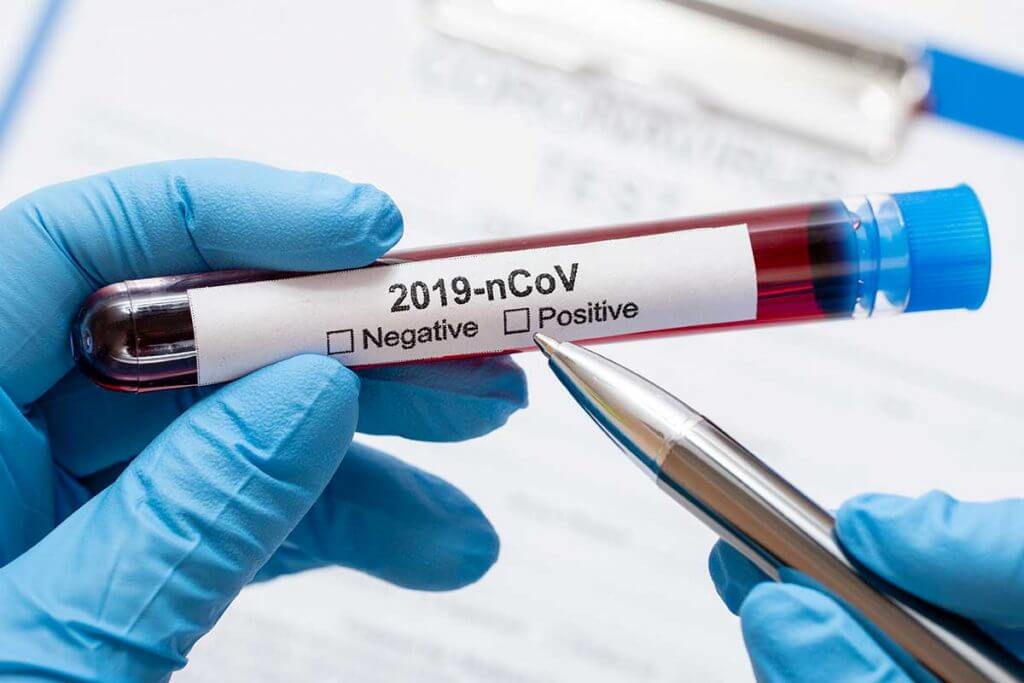 teste-do-coronavirus